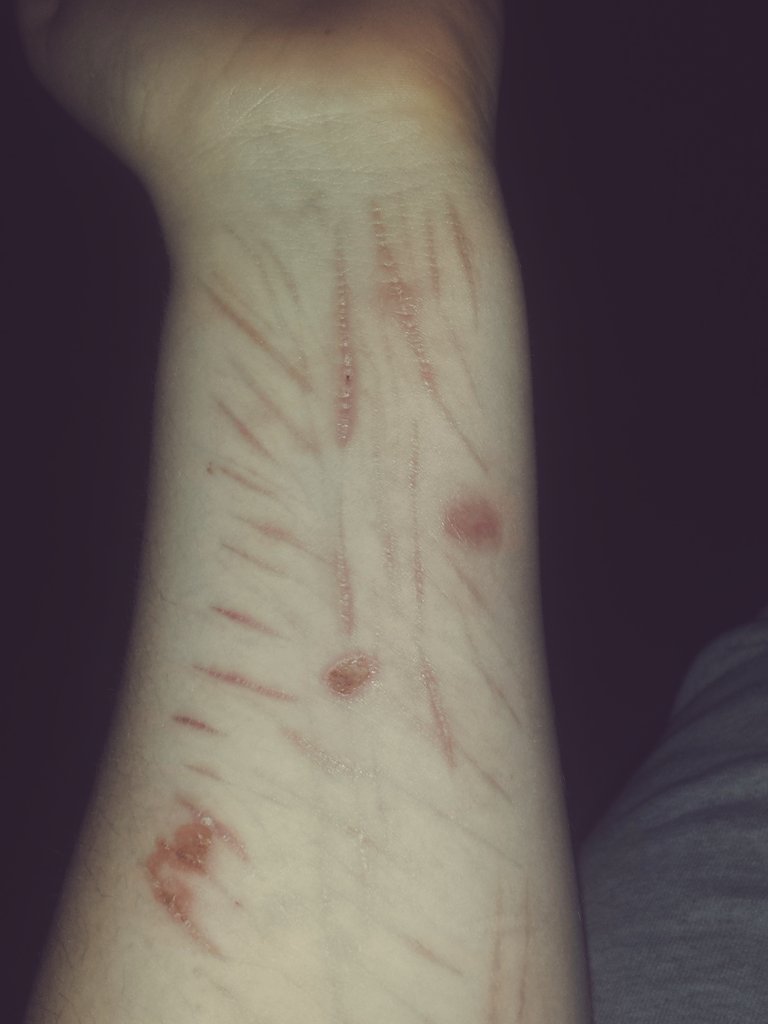 HalloImMia's tweet photo. I hope it will be gone til summer. I hope everything will fix. I hope so bad but I do not believe... https://t.co/sfJnlbnvqy