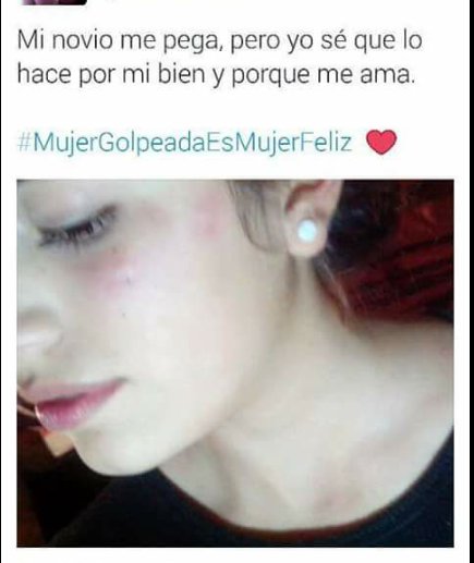 saimon_arevalos's tweet photo. Que loca está pendeja Rehabilitación lo que te hace falta https://t.co/rpYQlu16k8