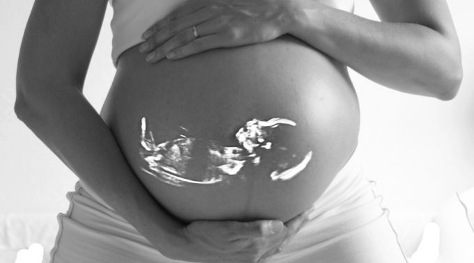 VIVErevista's tweet photo. Jóvenes celebrarán Día del Niño por Nacer en maternidad de Guayaquil. https://t.co/Coz2Wei4Ns @JovenProvidaEc https://t.co/Rj4xqFMMKX