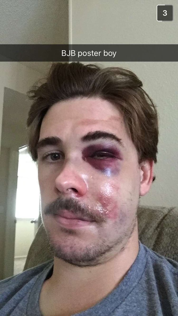 BarstoolChief's tweet photo. "So you wanna be a pro hockey player"

Rough rookie year for @JMansfield23 

First fight + a clapper to the face https://t.co/BdmtHGTgSt