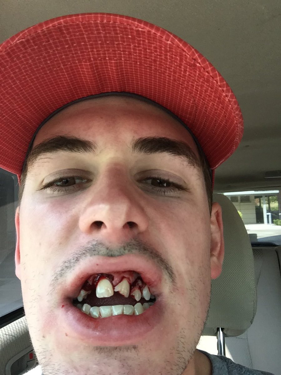 BarstoolChief's tweet photo. "So you wanna be a pro hockey player"

Rough rookie year for @JMansfield23 

First fight + a clapper to the face https://t.co/BdmtHGTgSt