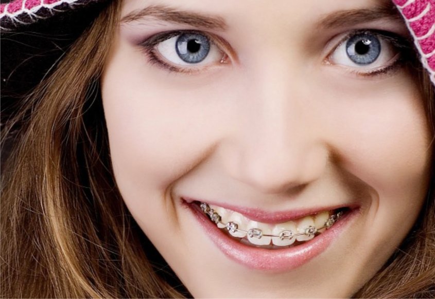 Sorrident_s's tweet photo. Aparelho fixo e móvel, você conhece a diferença? #Sorridents #SimplesComoSorrir >> https://t.co/2yovmcf7tQ https://t.co/IQ5xy27TLK