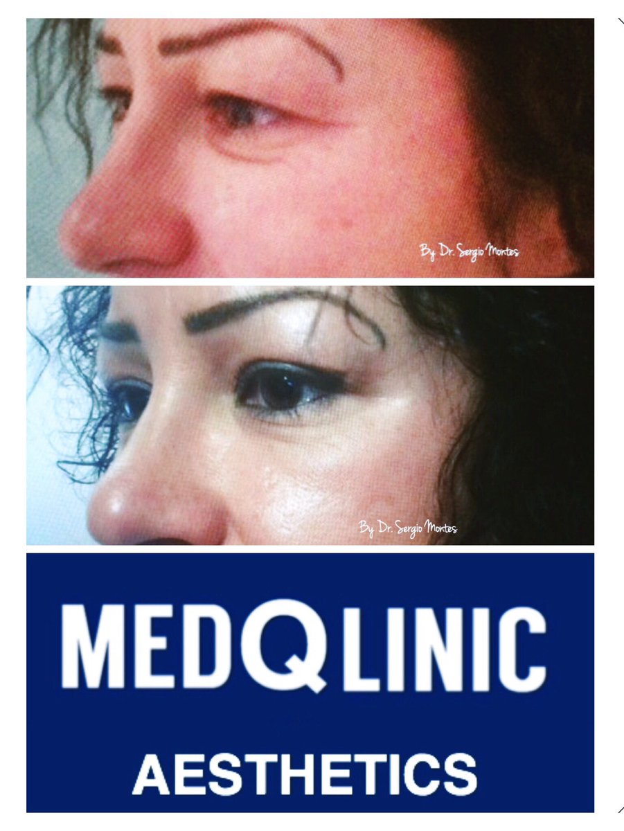 MEDQLINIC tweet picture