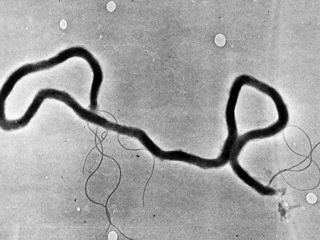 Share: Young people need reminder: Syphilis #HIV rates up in  north and west of Melbourne bit.ly/1q1aj8r