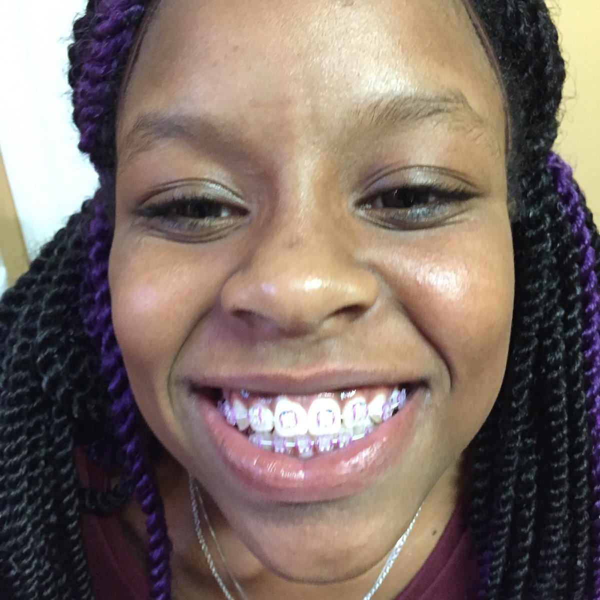 12 month smiles (@12monthsmiles) on Twitter photo 