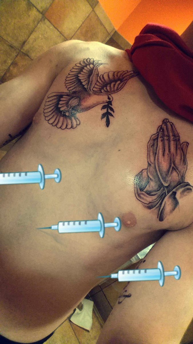 Jesse_Roy_'s tweet photo. 💉💉💉💉💉💉💉 https://t.co/WVOSUvLeo3