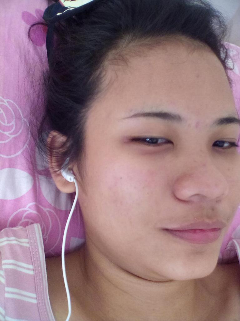 jamedusa_'s tweet image. Ung naging pink na muka mo dahil sa pimples. :D at taba ko na!! #pimpleproblems #justwokeup #selfieagad #selfie