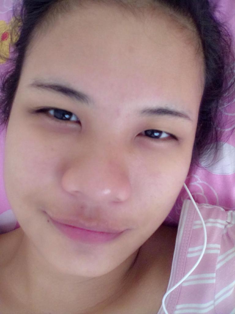 jamedusa_'s tweet image. Ung naging pink na muka mo dahil sa pimples. :D at taba ko na!! #pimpleproblems #justwokeup #selfieagad #selfie