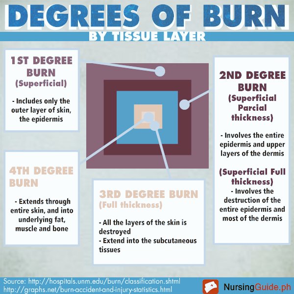 NursingProcedur's tweet photo. #Burns https://t.co/T9c9zJKIxA