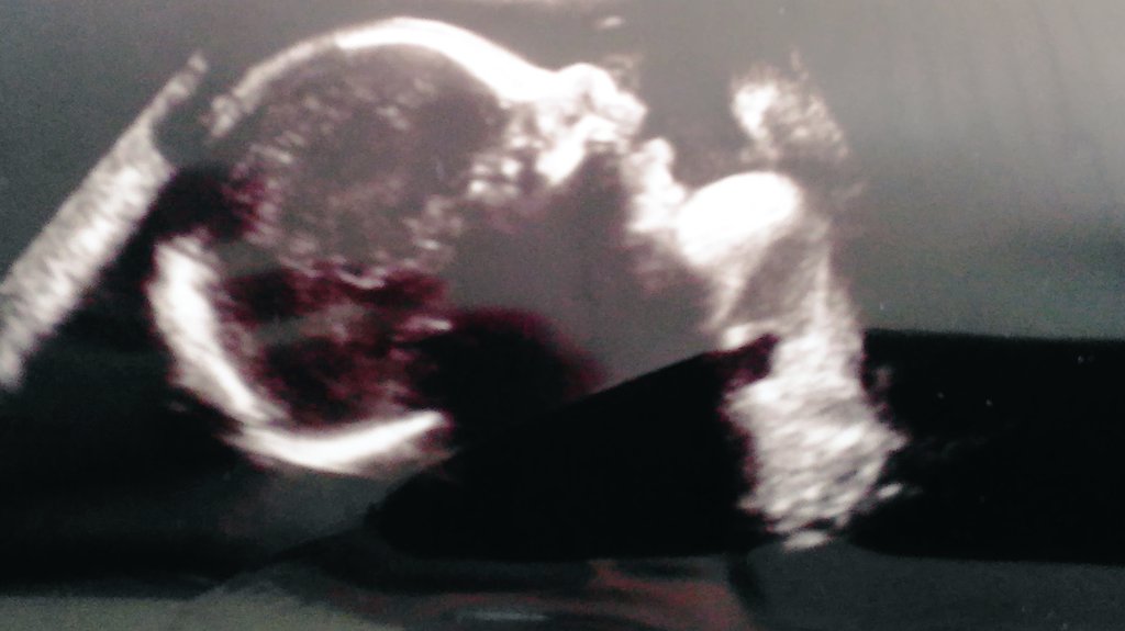 kamikazimami's tweet photo. #sashamorgan #baby #momlife #motherhood https://t.co/Jds9UUZOyk