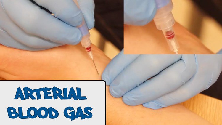 Neil Palin tweet media