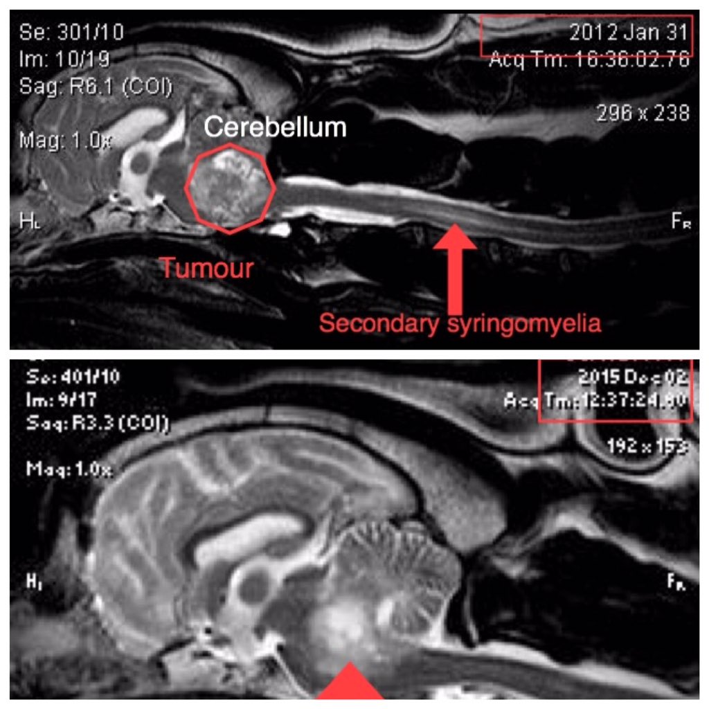aneNeuro's tweet photo. #braintumour before and after #radiationtherapy 4 years later in a #frenchbull #frenchy #frenchbouledogue https://t.co/Cca7rWmOpg