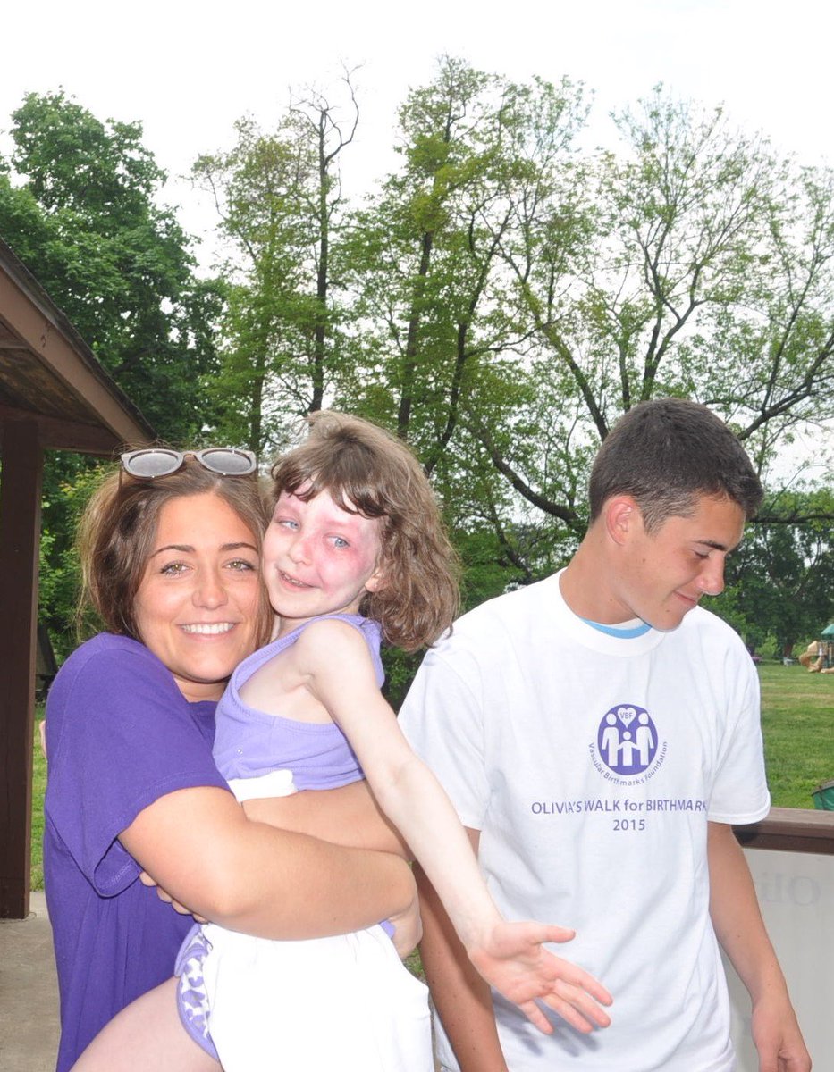 VBirthmarks's tweet photo. https://t.co/IVkHwB4ieF In the Bensalem, PA area? Raise #Birthmark awareness with us! Neshaminy State Park 4/30/16 https://t.co/63ZwpyVg4Z