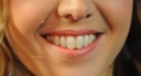 AxelDpt's tweet photo. Enora ses dents on dirait des dragées de mariage j'suis mort #TPMP https://t.co/bL9xTSBeAI