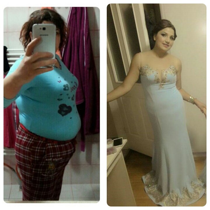 Siz de " Sağlıklı " bir şekilde Zayıflamak istiyorsanız Herbalife ürünlerini kullanın. Musterilerimizden biri 👍👏