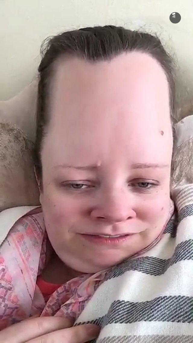 EveK22's tweet photo. @lovelygirlybits I actually howled at this filter. Nothing worse than sinus pain though. Feel better x https://t.co/F2QJIwxR6Z