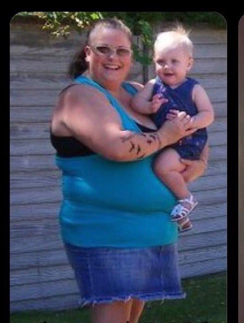 MrsLilDvl's tweet photo. #TBT to August, 2010... 349lbs... I've come a LONG way!!! Thanks to @AmitPandher, I'll NEVER be here, again!!!! https://t.co/7wshfY4ZfJ