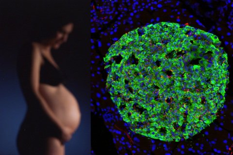 SeanMarkhamBW's tweet photo. Presence of Hormone at Key Developmental Period May Point to Origin of Type 2 Diabetes in... https://t.co/DXI4CBqQTU https://t.co/K856LZP6zO