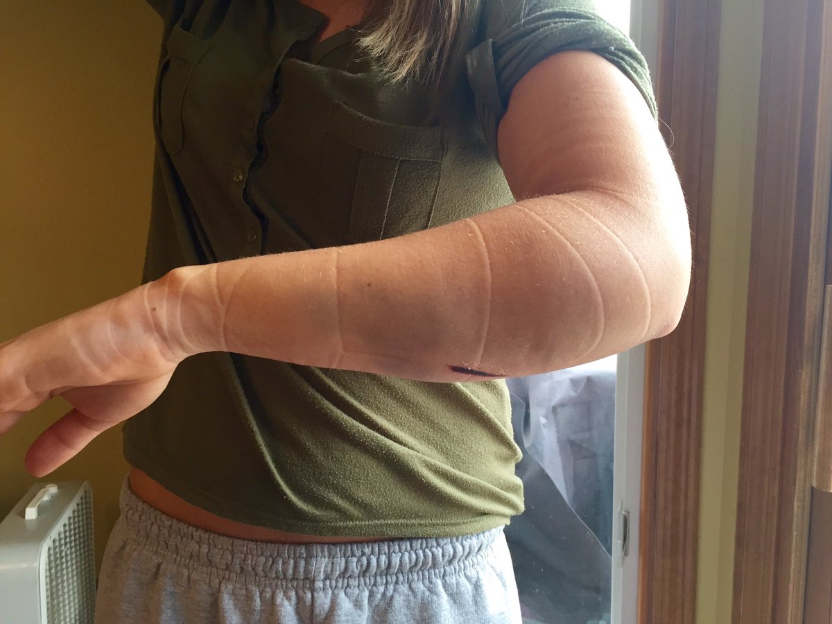 Kelli_Fridsma's tweet photo. Happy 1 year w/o falling down the stairs🎉 #GoKel https://t.co/uVD2gcxDP6