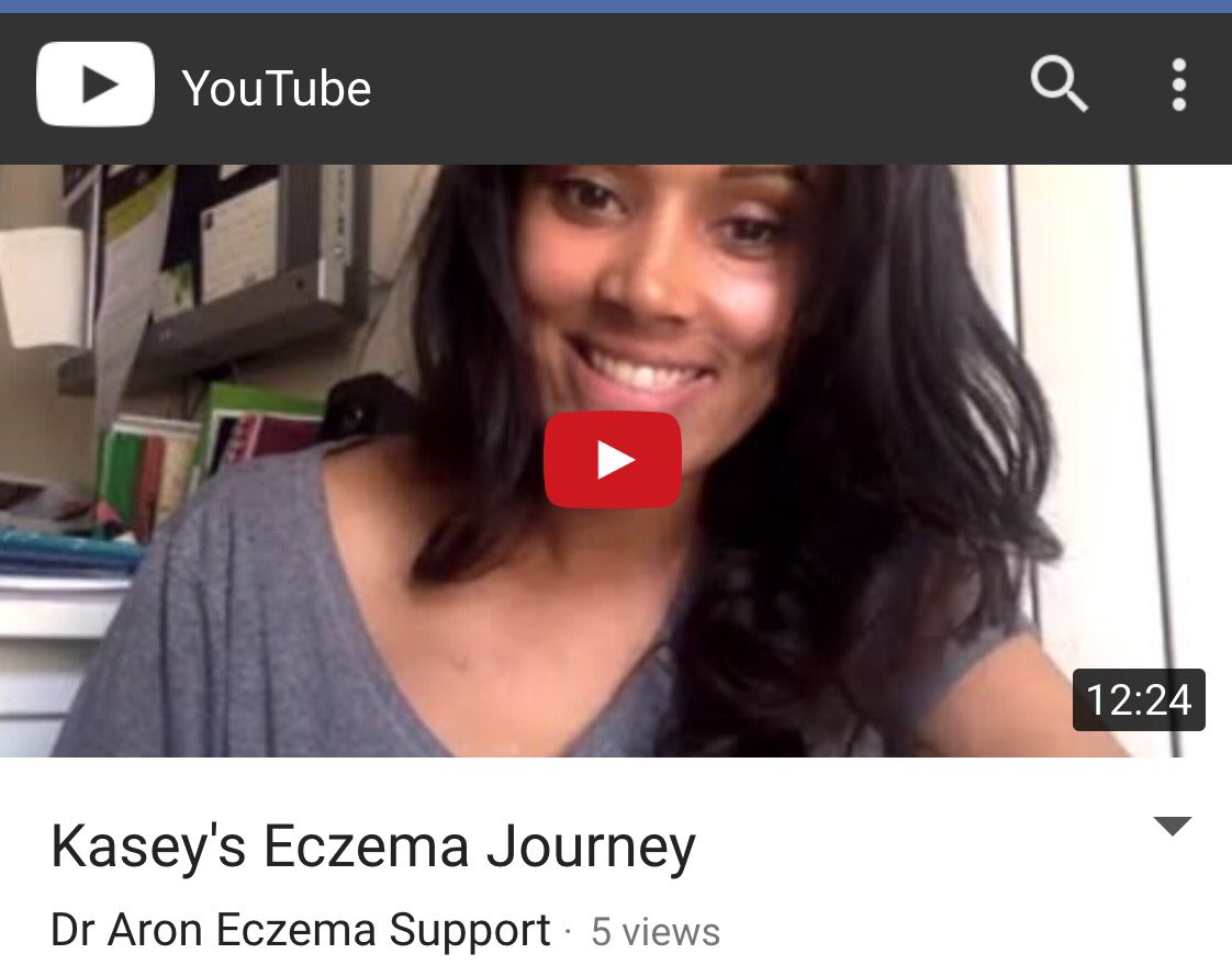 DrAronEczema's tweet photo. Link to video-> https://t.co/XnO5tfn1fs via @youtube #DrAron #Dermatologist #AtopicDermatitis #Eczema #EczemaHelp https://t.co/HpdVIGmVte