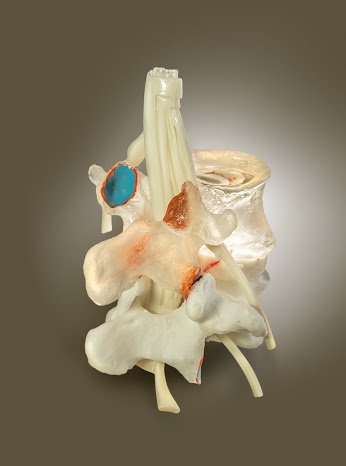 dynamicdisc's tweet image. A Selection of #HumanSpineModels Make #PatientEducation Easier
goo.gl/qtPU6B

#SpineModel #chiropractor