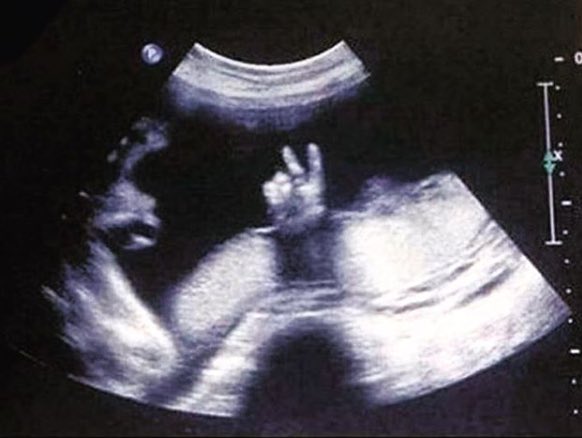 MiriMMX's tweet photo. @DebitorLP @DaniKocht hab eben ein Foto vom #debibaby gefunden.. https://t.co/DqT0k9kqmI