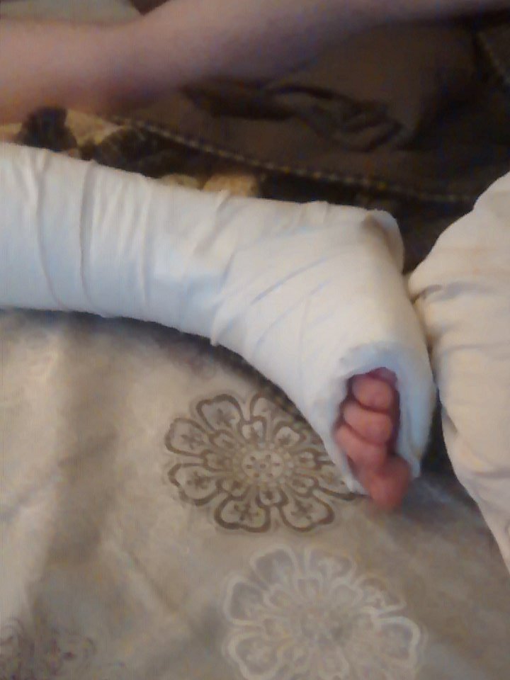 ee1975fc55ca44a's tweet photo. HA!!! Good one! April fools right? Oh... Wait you actually broke your ankle... Uhmmmmm..... Bye. https://t.co/UgJ5QapudN