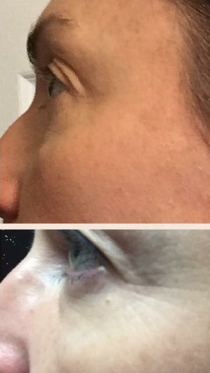 sunsetBchCO's tweet photo. Nerium just works its patented and proven this pic is me #neriumresults https://t.co/XMVuYkh7Uj