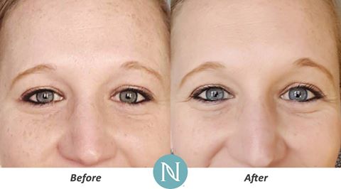 julieprie's tweet photo. #EstoyAsiDe joven gracias a Nerium! Pruébala por 30 días ! te va a encantar!
https://t.co/SEnSfZYtBu https://t.co/w2ciGEg7jD