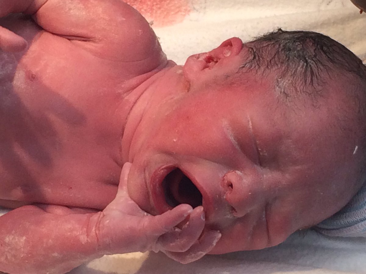 Nate Ottë tweet media