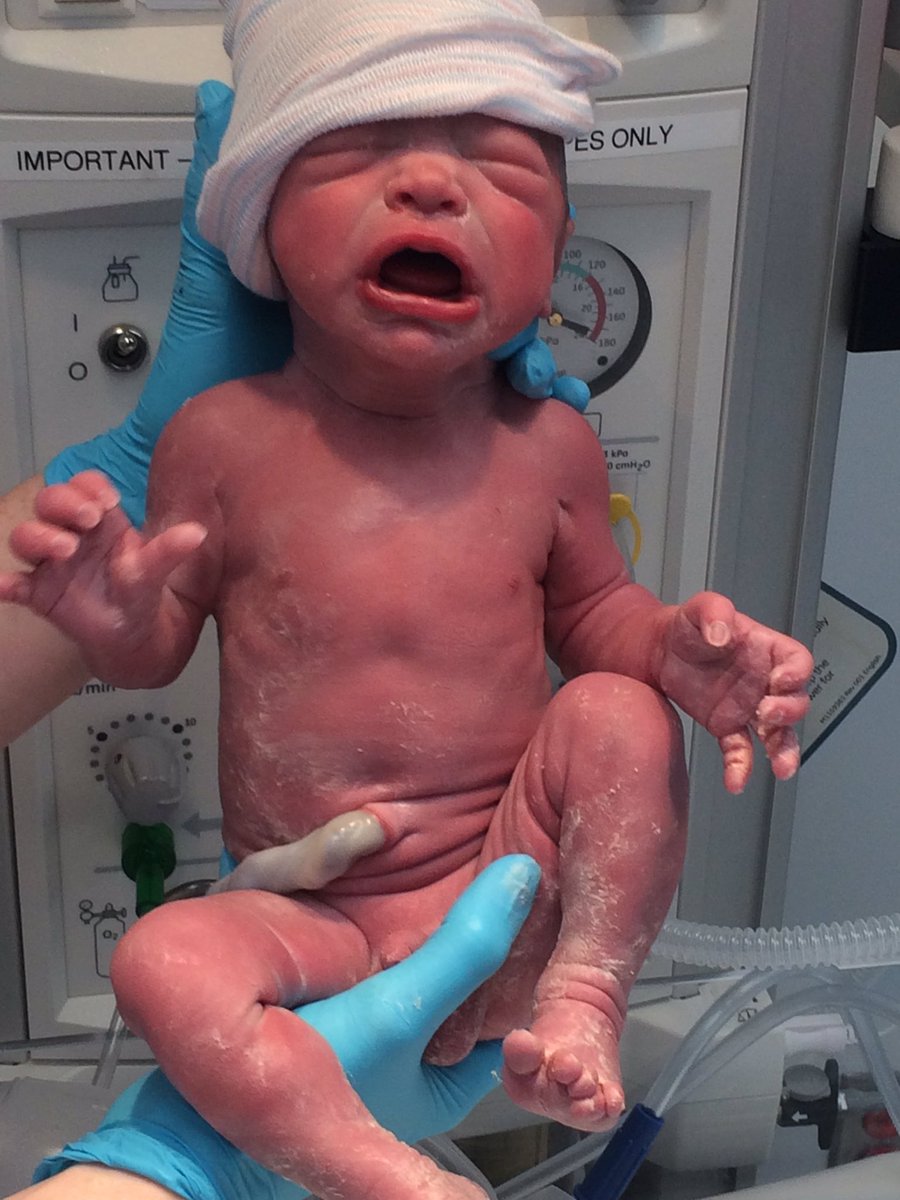 Nate Ottë tweet media