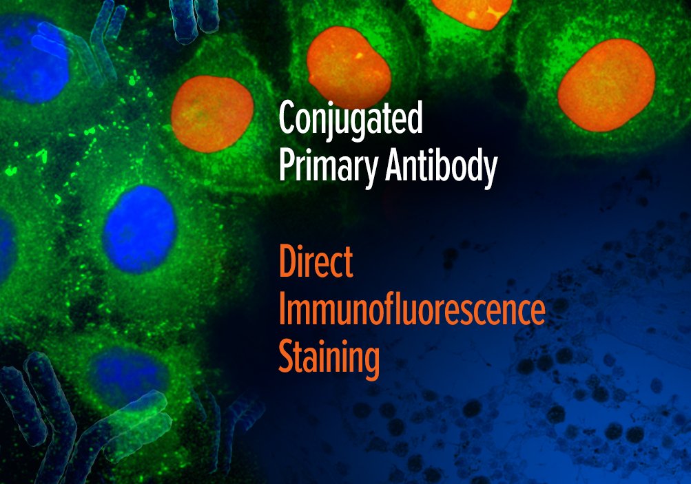 SantaCruzBio's tweet photo. Our popular #monoclonal #antibodies are now available conjugated to AC, HRP, FITC, PE, #AlexaFluor® 488 or 647. https://t.co/FH93xKLl7P