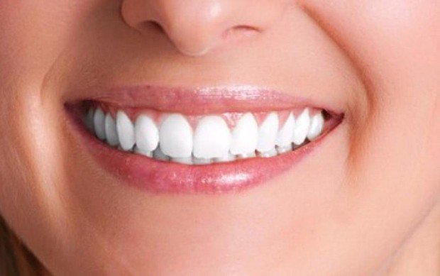 commonmedical's tweet photo. Check out Tooth Whitening Trends https://t.co/YqGIZaOu0I #Teethwhitening #oralhealth #Healthyteeth https://t.co/oFxMb52VGa