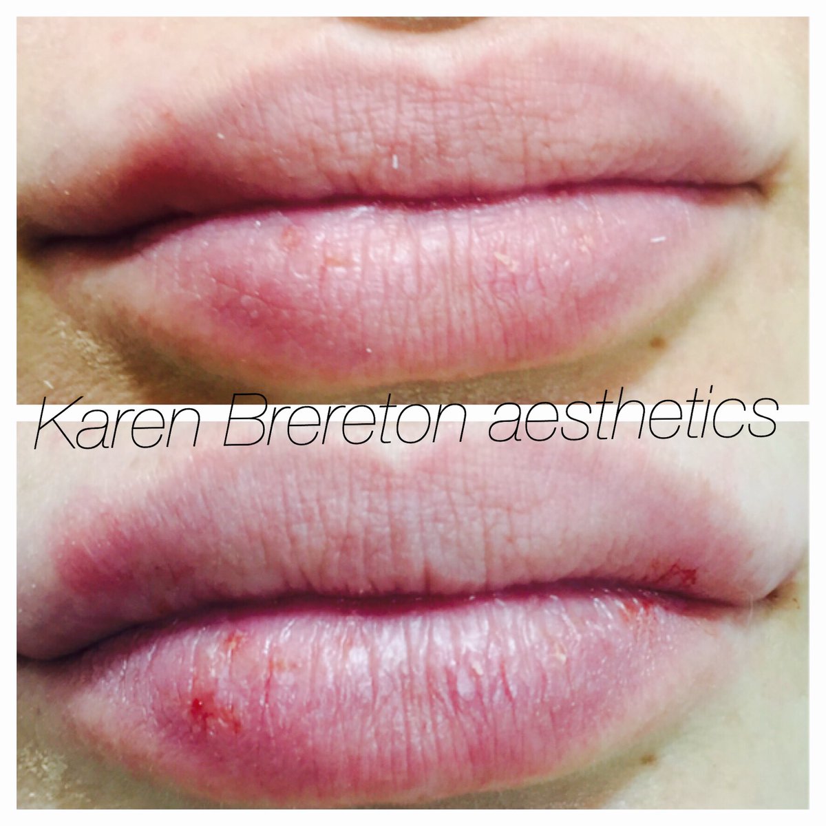 kaggie35's tweet photo. All about the lips https://t.co/iFW9wzhOYA