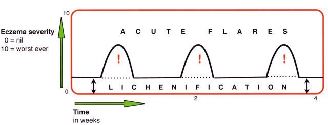 ckbridgett's tweet photo. #EczemaExplained 3/3 Chronic atopic #eczema & #lichenification https://t.co/Zs1vCX7jHm https://t.co/ZWnb0Di4JJ