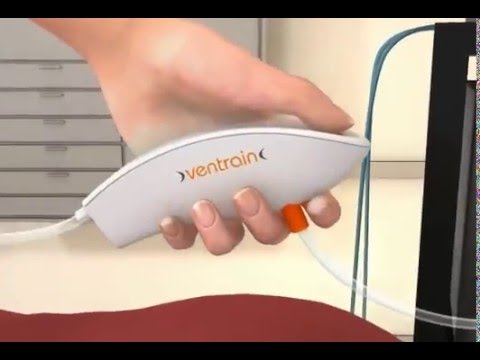 sesanltd's tweet photo. #Manuel #Jet #Ventilatör #Cihazı #Ventrain #Tanıtım https://t.co/XRSctp4X81 #medikal #sağlık #tıbbicihaz #hasta https://t.co/GfpQItQPZj