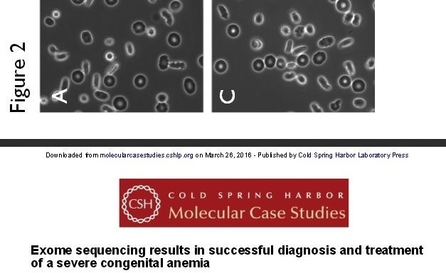 Primary_Immune's tweet photo. #Exome Seq-ing Cracks #RareDisease Case, Transforms Life of 3y.o. https://t.co/DI4B1lu3U1 #SNRTG #BigData #genomics https://t.co/ZUx4PmcHBG