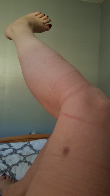 Beautiful # rope marks from my shoot with @RopeSaico today.  Had a fabulous time.  Even with the feet<a class="tags" target="_blank" title="On Twitter" href="/?out=eyJ0eXAiOiJKV1QiLCJhbGciOiJIUzUxMiJ9.eyJpYXQiOjE3MjUxMzUzMjcsImlzcyI6InR3cG9ybnN0YXJzLmNvbSIsIm5iZiI6MTcyNTEzNTMyNywiZXhwIjoxNzU2NjcxMzI3LCJyZWRpcmVjdF91cmwiOiJodHRwczovL3R3aXR0ZXIuY29tL1JvcGVTYWljbyJ9.LBAqWGFlQ-v1WUgDTyRGZSOJeOHak8fMgtfMte7Tf80gUaXO_hDiMiWGKEiqYr6QBhr3_Vg5dezWgqs3Nq9TbA">@RopeSaico</a><a href="/tag/earthquake"class="tags"><span>#earthquake</span></a>