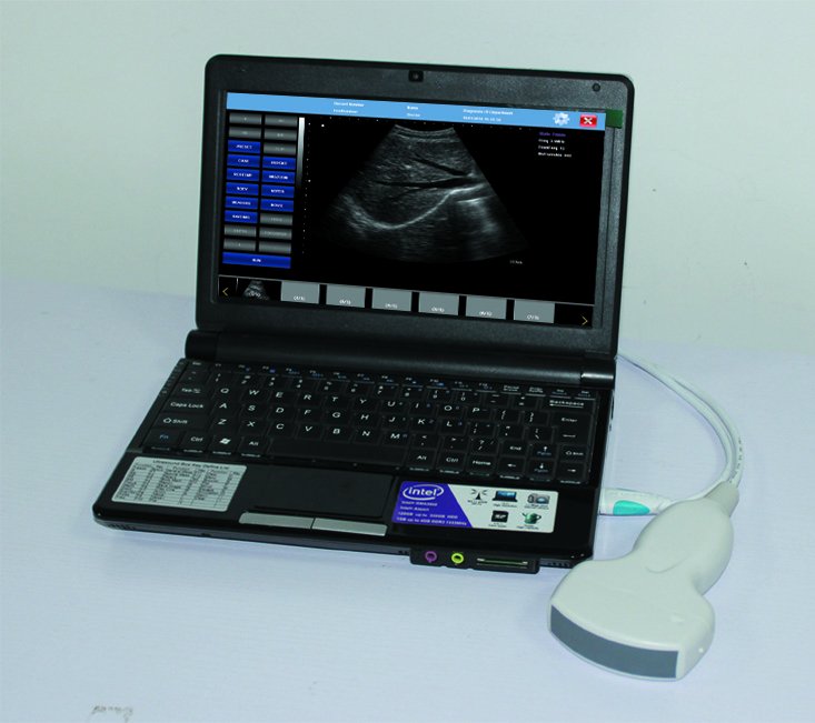 TonyUltrasound's tweet photo. USB probe ultrasound scanner probe, connect with windows systems computer, tablet. https://t.co/OP38Hwmrm9