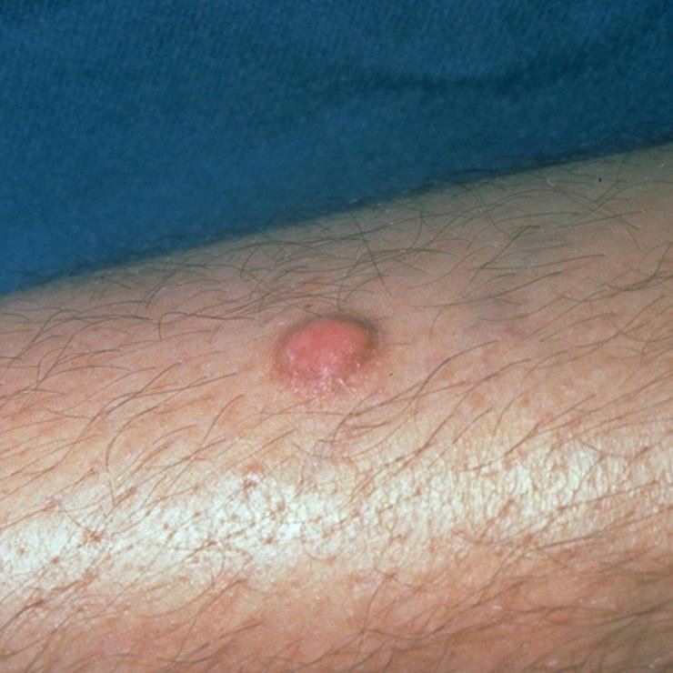 ESSClinic tweet picture