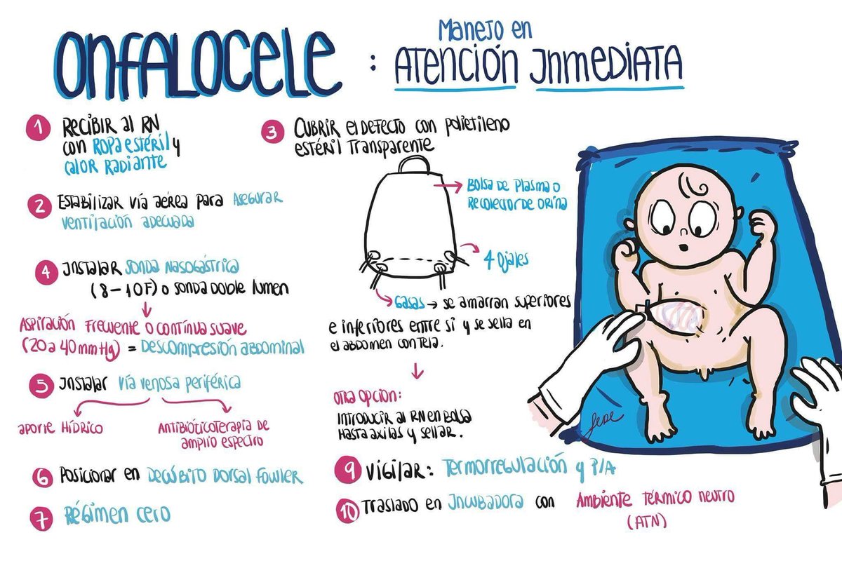 MedicinaCrash's tweet photo. Onfalocele. @drcarlosrepetto https://t.co/hwafxuIwrp