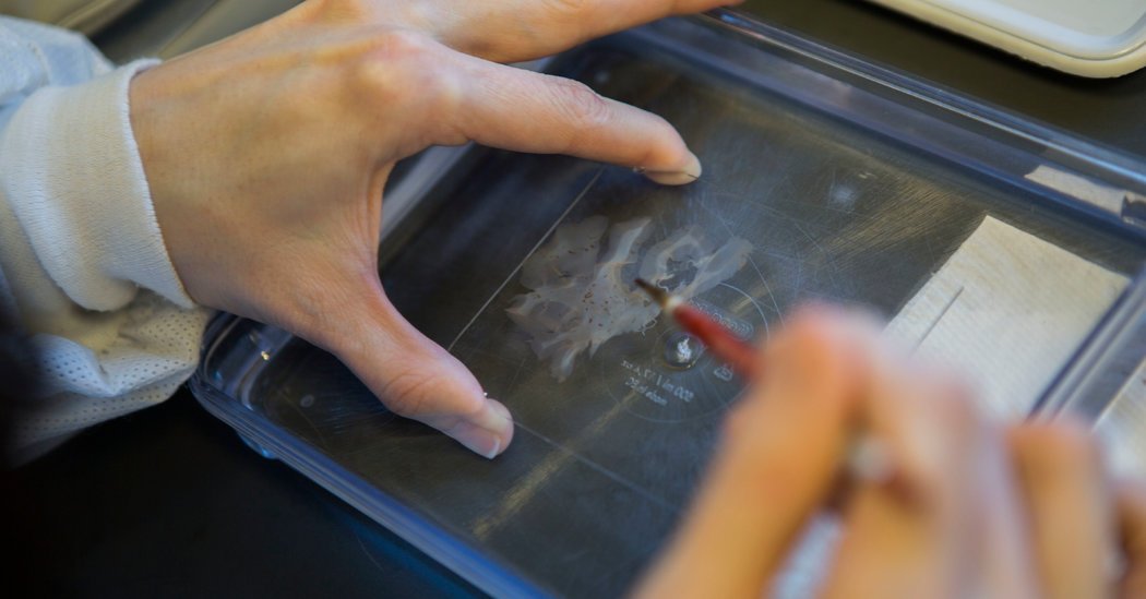 Some brain injury experts are warning against overreacting to C.T.E. findings nyti.ms/1q9WaG2