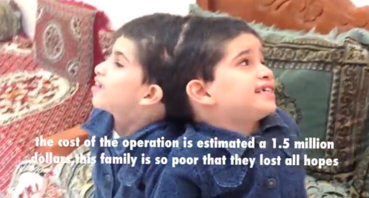 مازلت أتحرى خبر  #التوأم_الجزائري
اسأل الله أن يسخر خادم الحرمين الشريفين
الملك سلمان بن عبدالعزيز ال سعود
حفظه الله