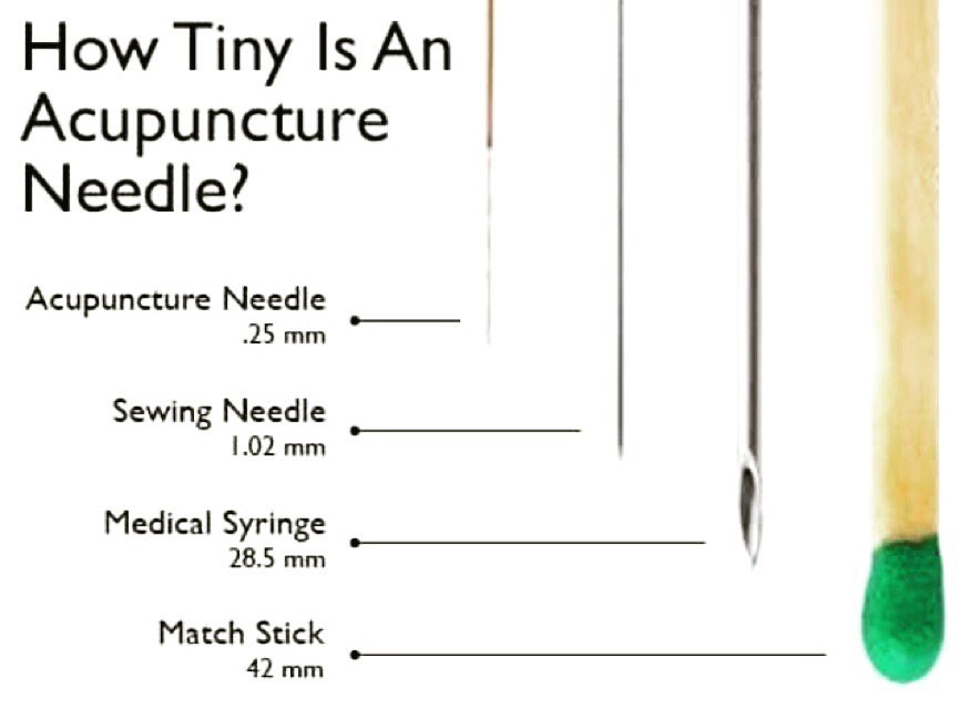 centeredstudios's tweet photo. Good things come in small packages! #acupuncture https://t.co/vDeoS8vmoQ