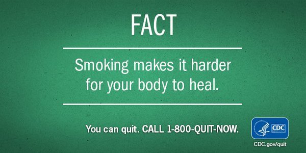 stopsmokingidea's tweet photo. Keep yourself healthy and quit smoking today! 
Get copy of Quit smoking in 4weeks book visit https://t.co/TD7Kf6oMcx https://t.co/mSmIg3xxgg