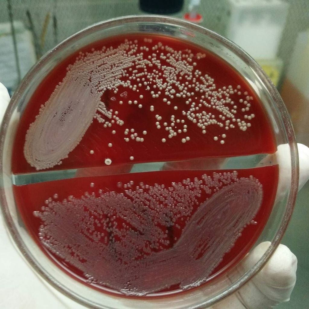 The Caring Times Twitterissä: "Staph sciuri and E.coli on blood agar