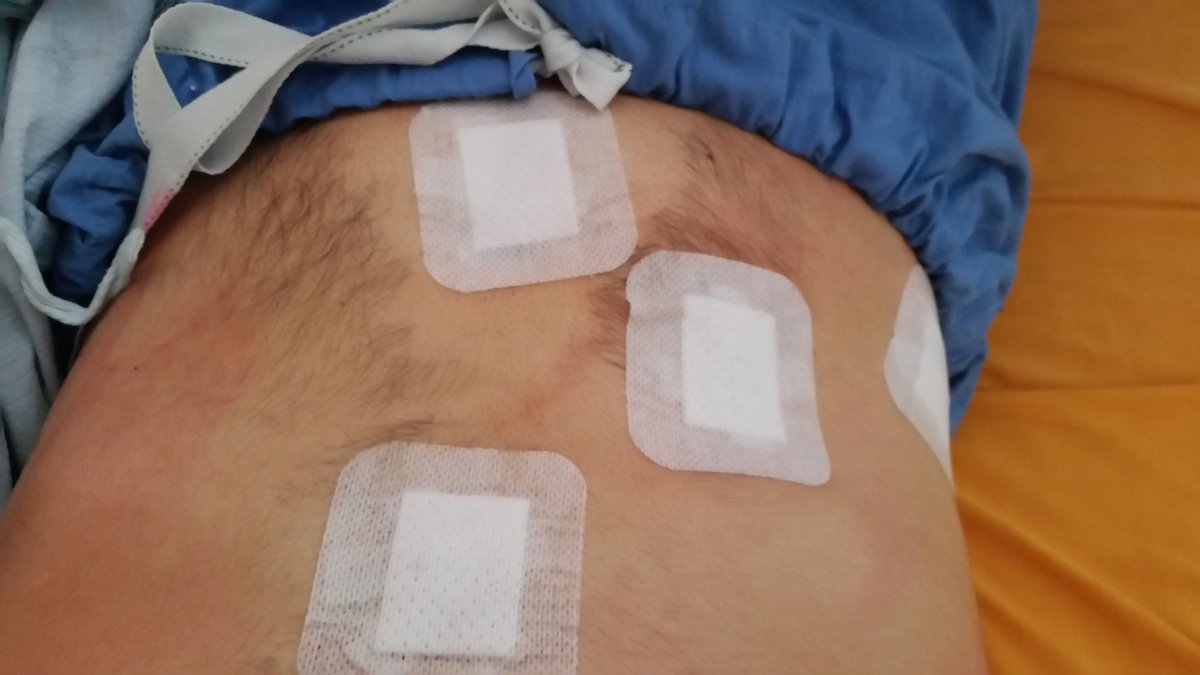 //after surgery. God my insides felt funny after. Pockets of gas still inside during recover made my insides. Jiggle