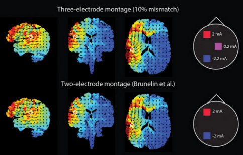 SoterixMedical's tweet photo. #HDExplore used in this study https://t.co/lUP2D0Et5S. Plan #tDCS trials with our easy-to-use interface. https://t.co/fY59QKac3X
