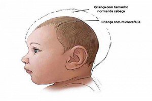 VirusZikaInfo's tweet photo. El virus zika y el embarazo https://t.co/XImoIry3OT #zika https://t.co/jXyhFtgW4z