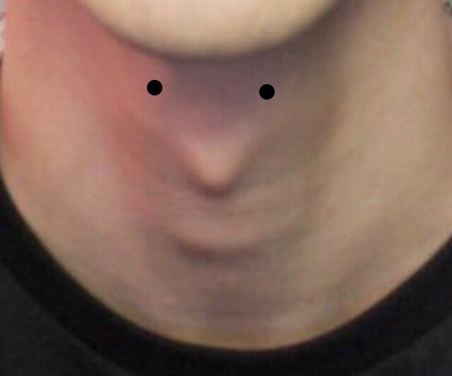 TroyeCommunity's tweet photo. He's back. https://t.co/wCEGxoq1ll
